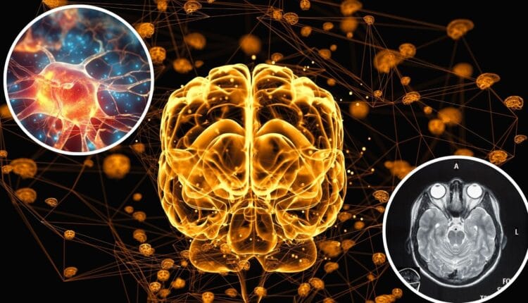 Des chercheurs ressuscitent un cerveau 1h après la mort